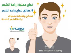 Read more about the article نجاح عملية زراعة الشعر