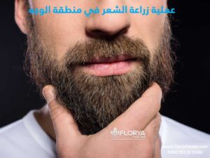 Read more about the article عملية زراعة الشعر في منطقة الوجه