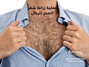 Read more about the article عملية زراعة شعر الصدر للرجال