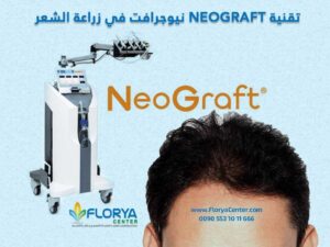 Read more about the article تقنية NEOGRAFT نيوجرافت في زراعة الشعر