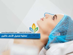 Read more about the article عملية تجميل الأنف بالليزر