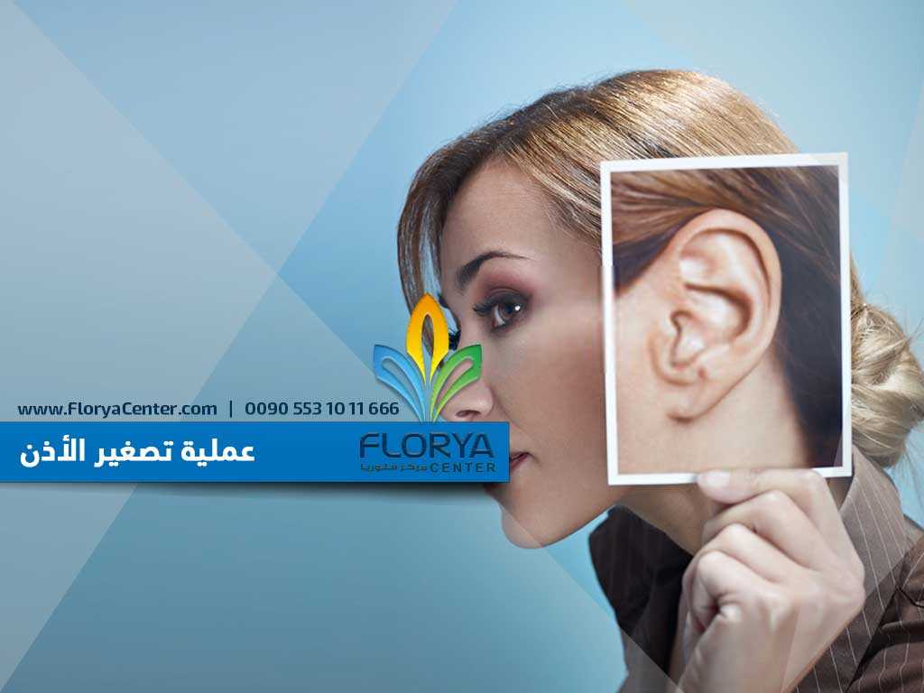 You are currently viewing عملية تصغير الأذن