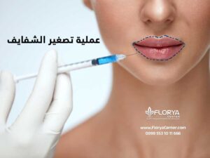 Read more about the article عملية تصغير الشفايف