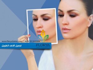 Read more about the article تجميل الانف الطويل