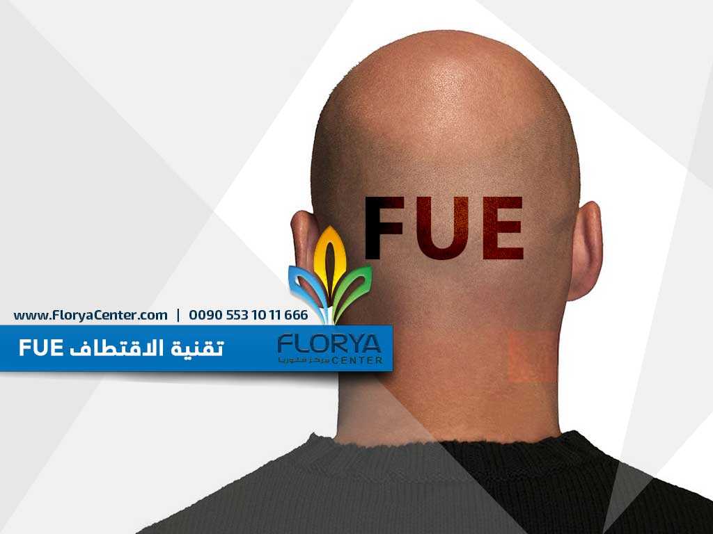 You are currently viewing تقنية الاقتطاف FUE