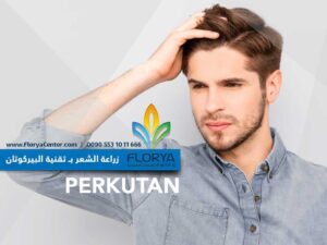 Read more about the article تقنية البيركوتان PERKUTAN في زراعة الشعر