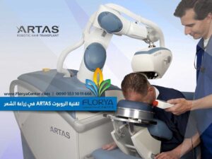 Read more about the article تقنية الروبوت ARTAS في زراعة الشعر
