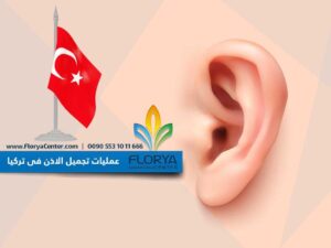 Read more about the article عمليات تجميل الاذن فى تركيا
