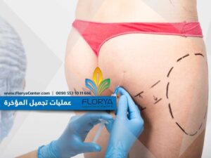 Read more about the article عمليات تجميل المؤخرة