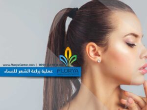 Read more about the article عملية زراعة الشعر للنساء