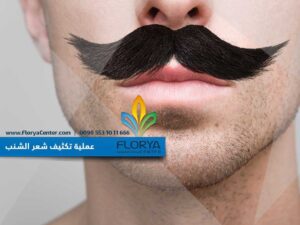 Read more about the article عملية تكثيف شعر الشنب