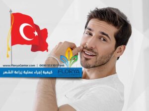 Read more about the article كيفية إجراء عملية زراعة الشعر في تركيا ملف شامل ومتكامل