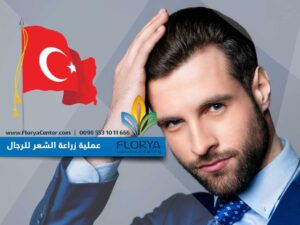 Read more about the article عملية زراعة الشعر للرجال