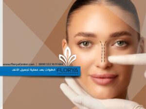 Read more about the article خطوات بعد عملية تجميل الأنف