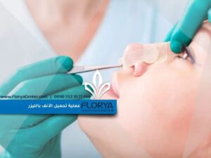 Read more about the article عملية تجميل الأنف بالليزر