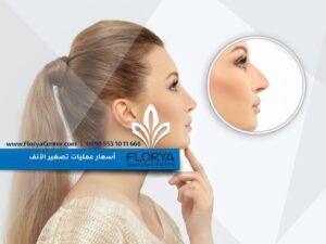 Read more about the article أسعار عمليات تصغير الأنف