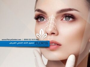 Read more about the article تجميل الأنف اللحمي العريض