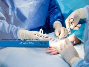 Read more about the article جراحة تجميل اليد