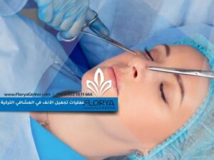 Read more about the article أسعار عمليات تجميل الأنف في المشافي التركية