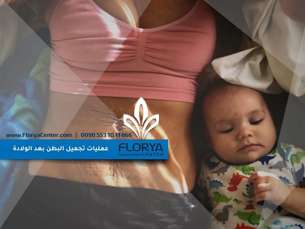 You are currently viewing عمليات تجميل البطن بعد الولادة