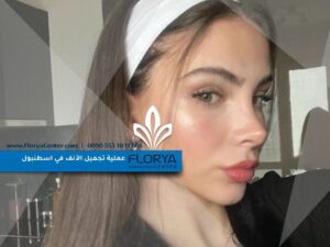 Read more about the article عملية تجميل الأنف في اسطنبول