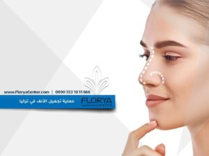 Read more about the article عملية تجميل الأنف في تركيا