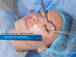 Read more about the article ما هي عملية تجميل جفن العين العلوي؟
