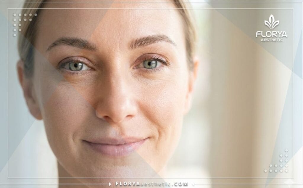 Résultat esthétique parfait d'un lifting des sourcils montrant un regard ouvert