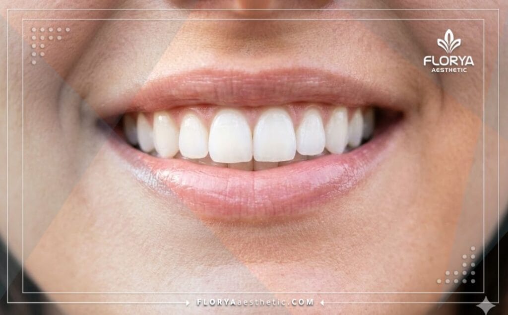 Крупный план идеальной белой улыбки после процедуры