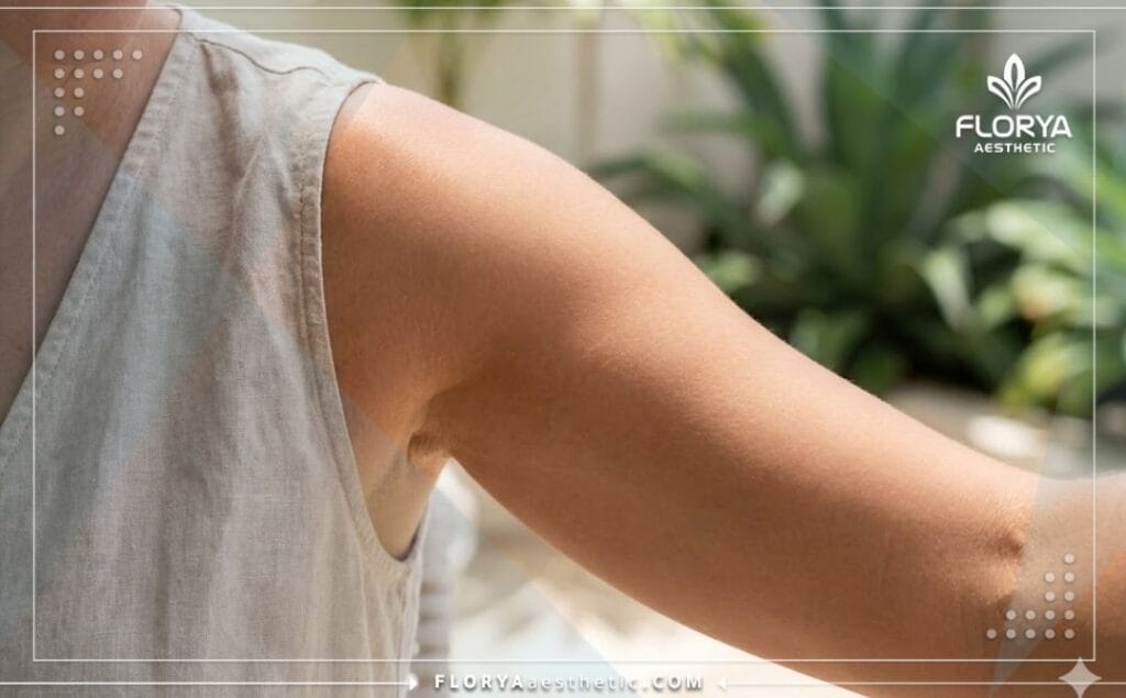 صورة مقربة تظهر النتيجة المثالية والجلد المشدود بعد عملية تجميل الذراعين.