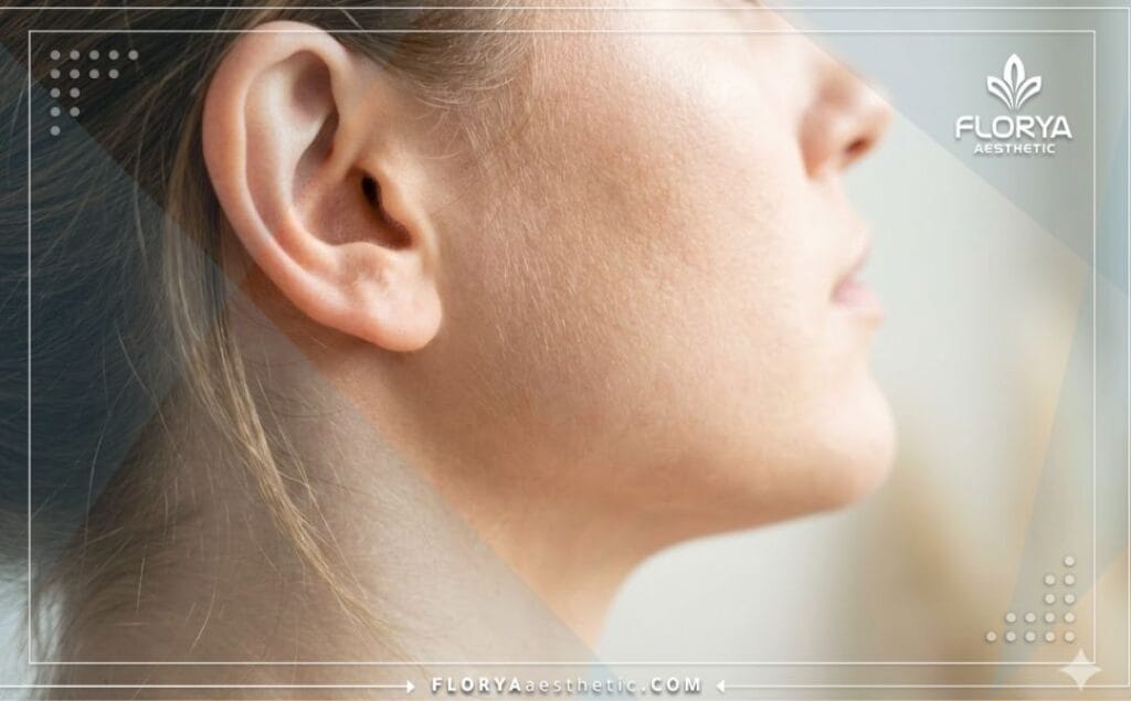 صورة مقربة تظهر النتيجة المثالية والطبيعية لعملية تجميل الأذن وتحسين المظهر الجانبي.