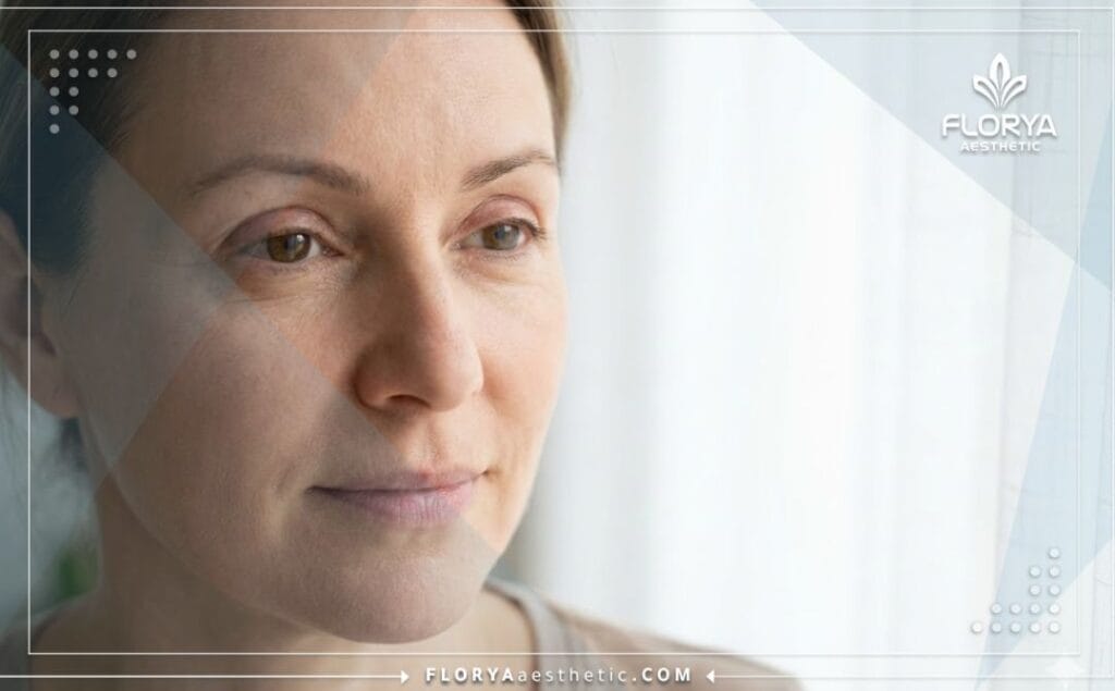 Идеальный результат пластики век крупным планом