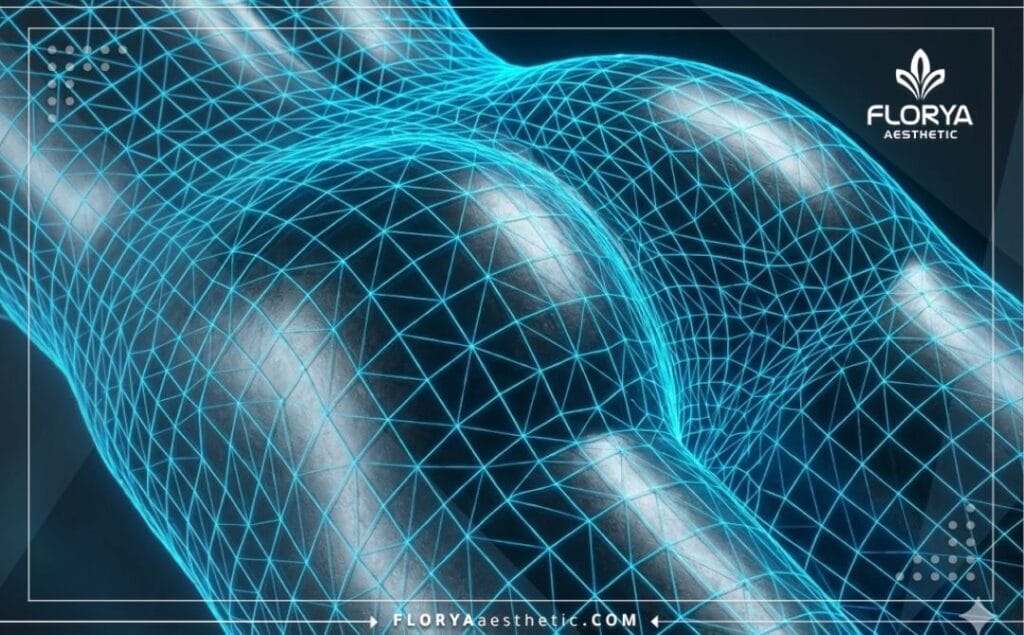 Scan 3D numérique de la zone fessière pour la planification chirurgicale