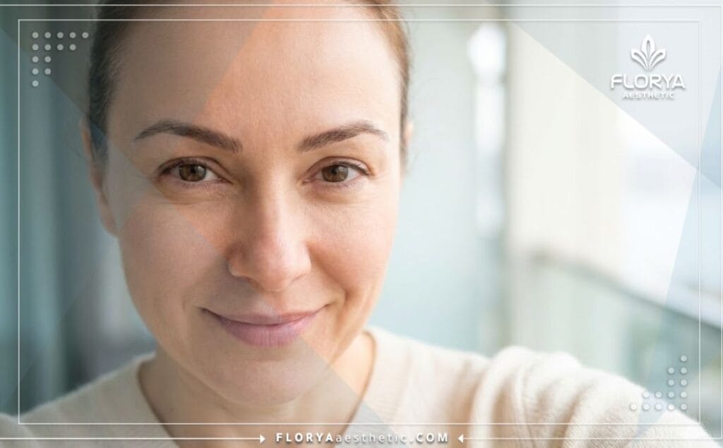 Идеальный результат подтяжки бровей крупным планом