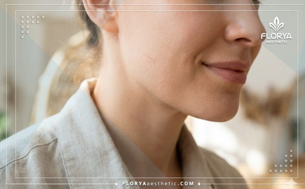 صورة مقربة تظهر النتيجة المثالية والطبيعية بعد إجراء جراحة تجميل ناجحة