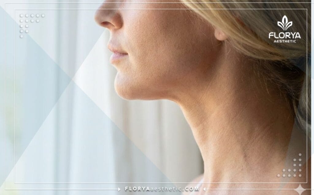 Идеальный контур челюсти после липосакции второго подбородка