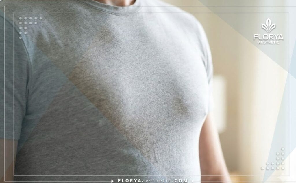 نتيجة مثالية لصدر مسطح وجذاب بعد نجاح علاج التثدي