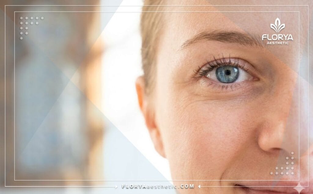 Gros plan sur un œil clair montrant le résultat parfait du Femto Lasik