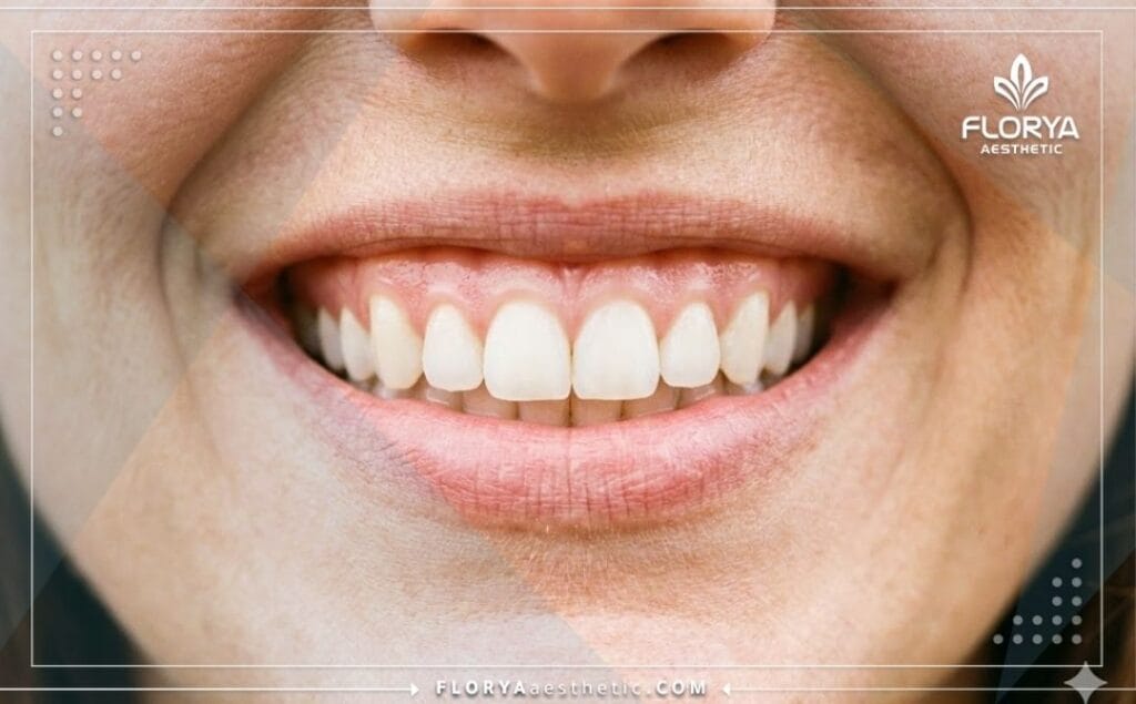 Close-up of a flawless smile showing perfect gum contouring results