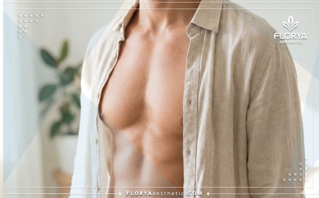 نتيجة مثالية ومظهر صدر مشدود وجذاب بعد عملية إزالة التثدي.