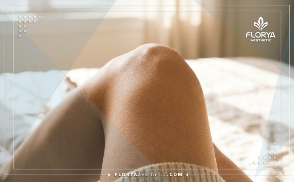 صورة مقربة تظهر النتيجة المثالية والناعمة لمنطقة الركبة بعد التجميل