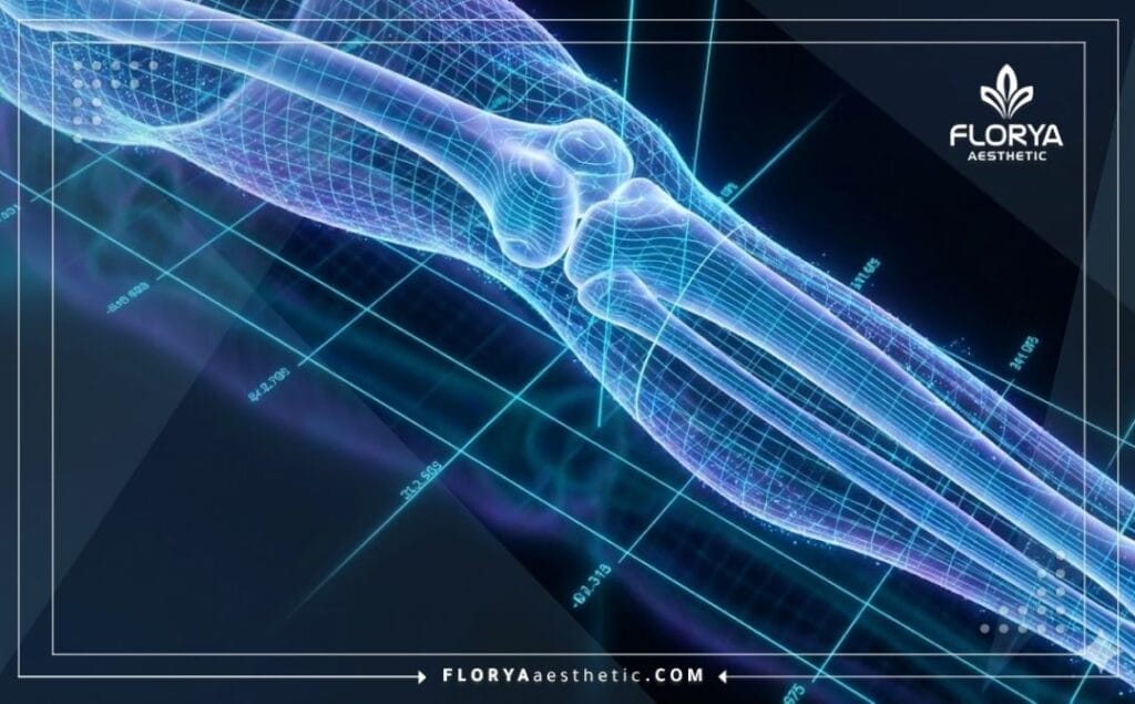 مسح ضوئي ثلاثي الأبعاد يظهر تقنية تطويل عظام الساق بدقة عالية