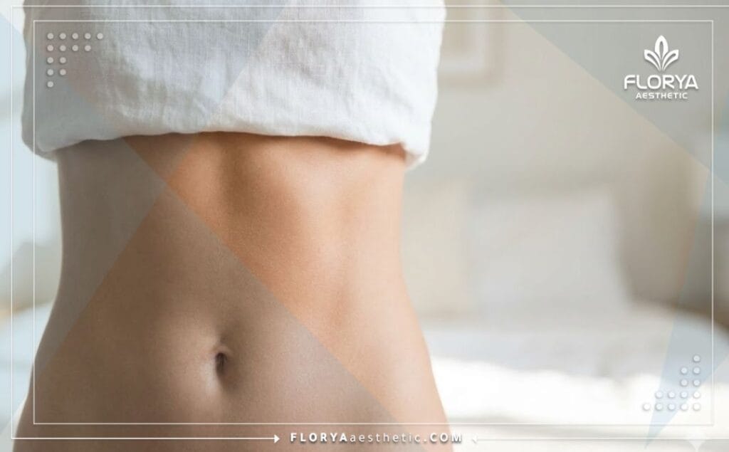 Flawless skin texture and toned body showing the result of laser lipolysis.