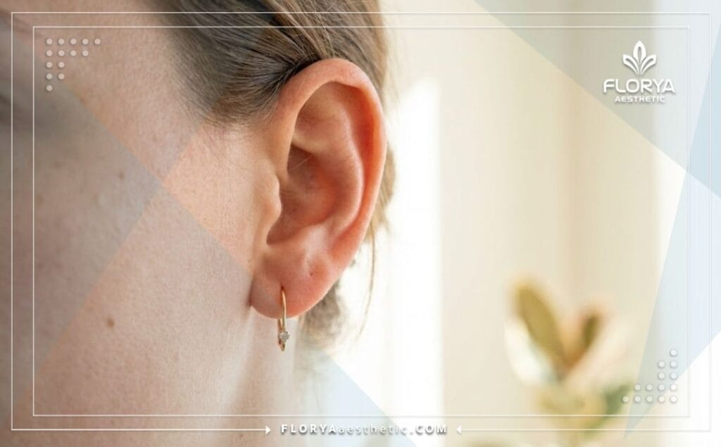 Идеальный результат коррекции формы ушей крупным планом