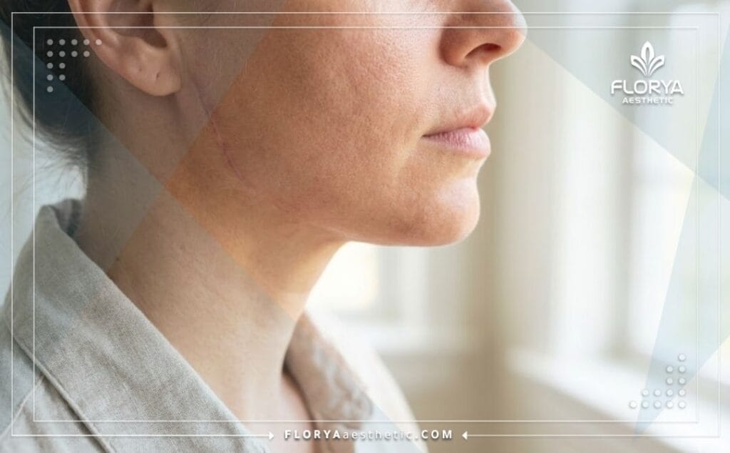 Primer plano que muestra el resultado exitoso y la piel curada tras la cirugía.