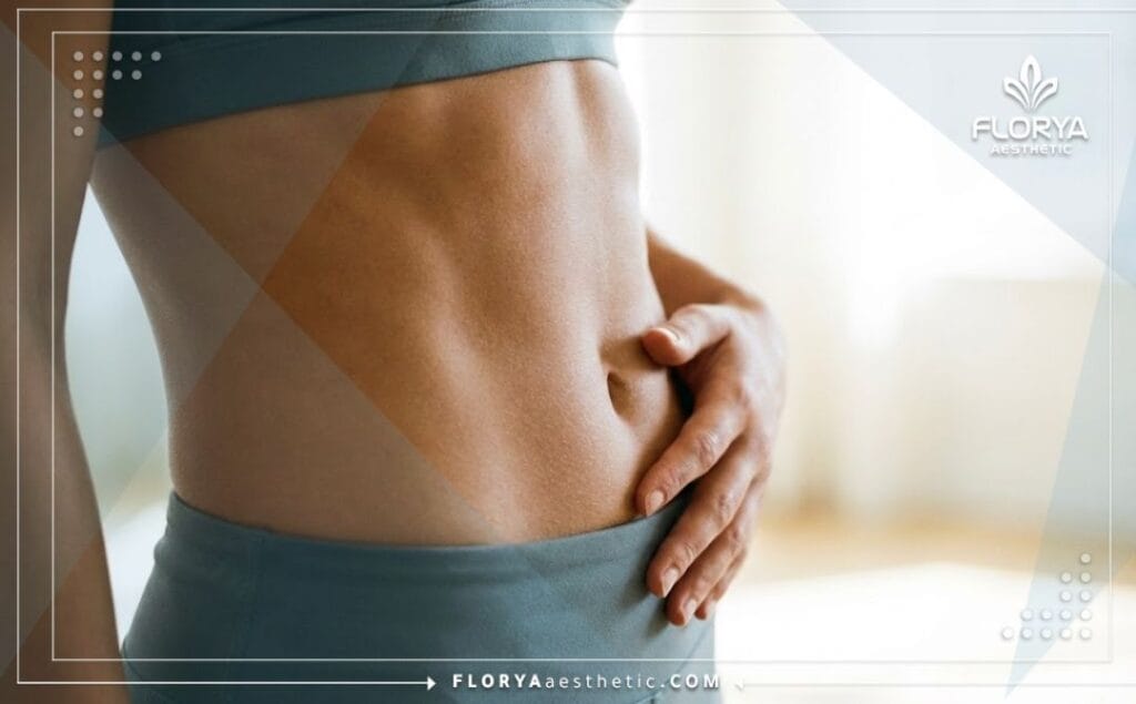 Flawless sculpted body result demonstrating the value of Smart Lipo Cost in Turkey.