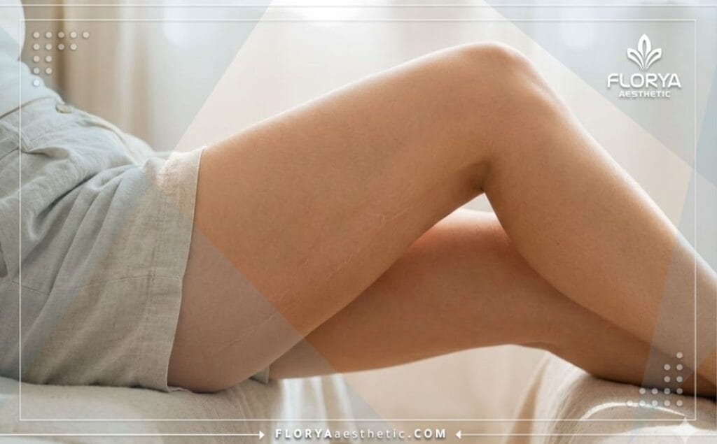 Primer plano cinematográfico que muestra el resultado perfecto y la piel suave tras el lifting.