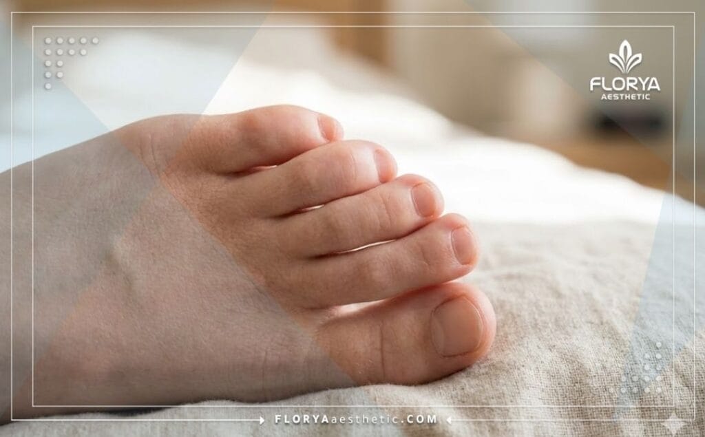صورة مقربة تظهر النتيجة المثالية والجمالية لأصابع القدم بعد عملية التقصير.