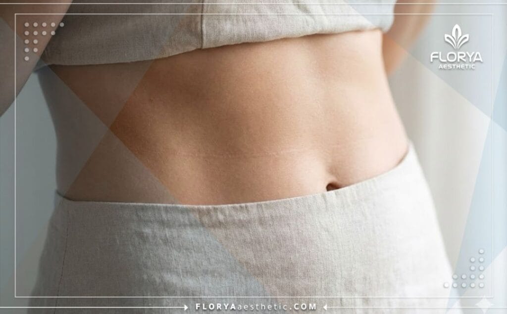 صورة مقربة تظهر النتيجة المثالية لعملية شد البطن وبطن مسطح وجذاب.