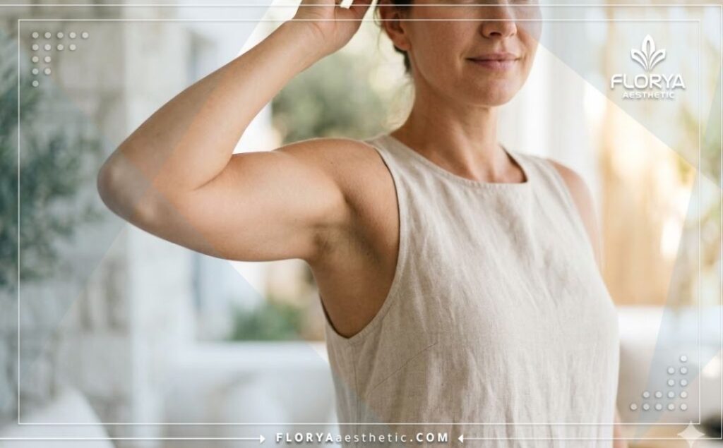 Close-up showing the perfect, sculpted, and toned results of a successful arm liposuction procedure.